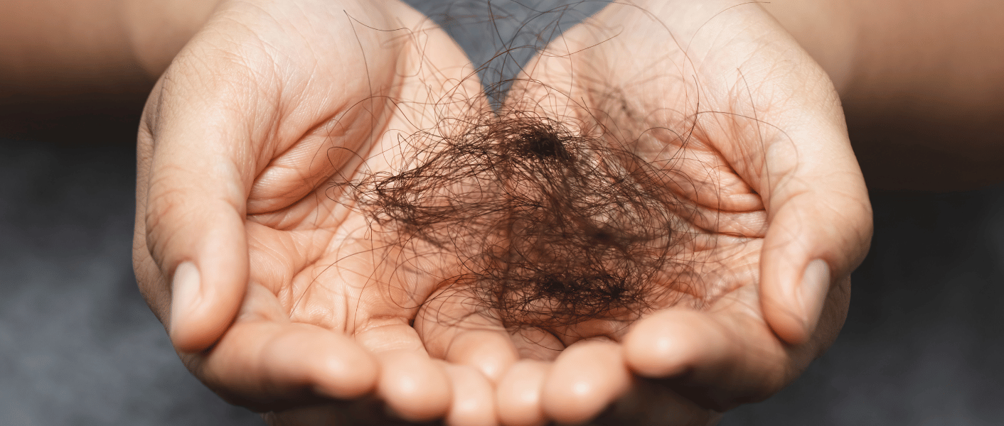 Exosomes in Hair Loss: The Future of Hair Regrowth